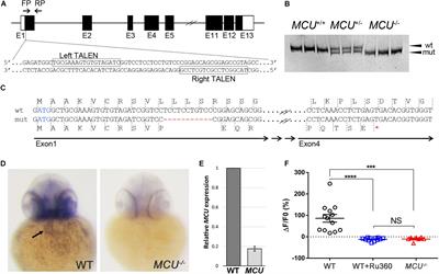 Mitochondrial Calcium Uniporter Deficiency in Zebrafish Causes Cardiomyopathy With Arrhythmia